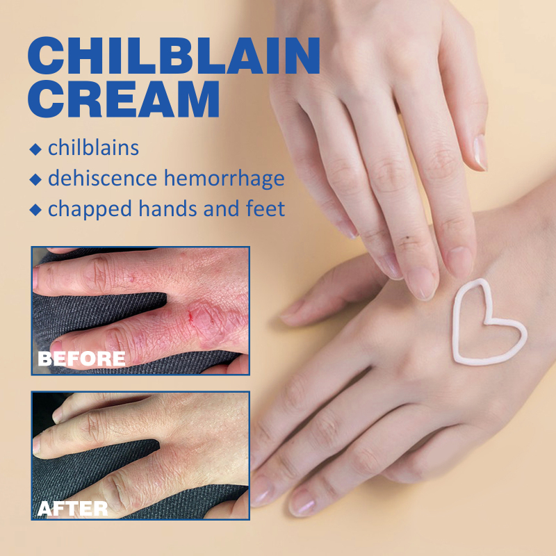 South Moon Skin Care Cream, Foot And Heel Nourishing Care, External Application - Image 3