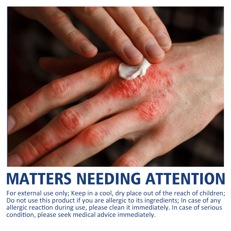 South Moon Skin Care Cream, Foot And Heel Nourishing Care, External Application - Image 4