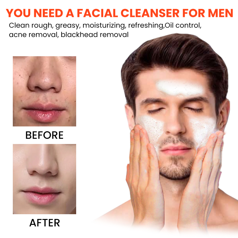 East Moon Men's Volcanic Face Wash, Acne Blackhead Face Deep Clean Pores And Oil Control - Image 2