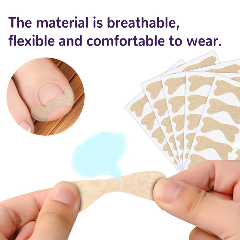 EELHOE Elastic Toenail Correction Patch, Nail Groove Correction Nail Repair Ingrown Nail Patch - Image 5