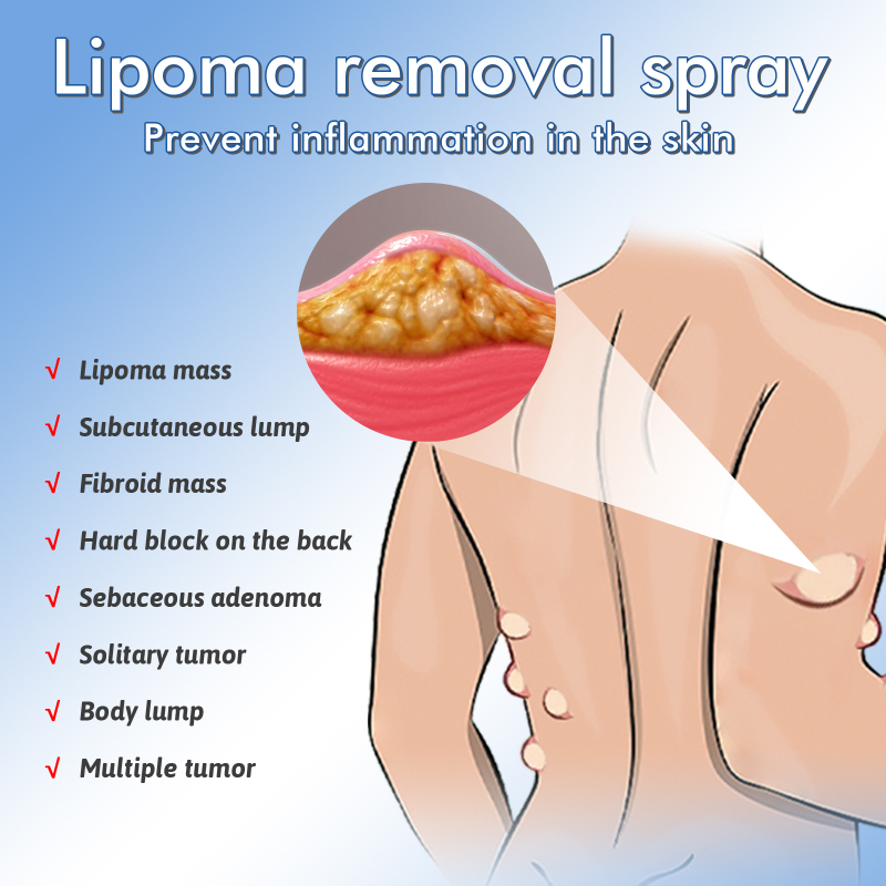 South Moon Body Treatment Spray, Repair Leg Back Body Treatment Spray - Image 4