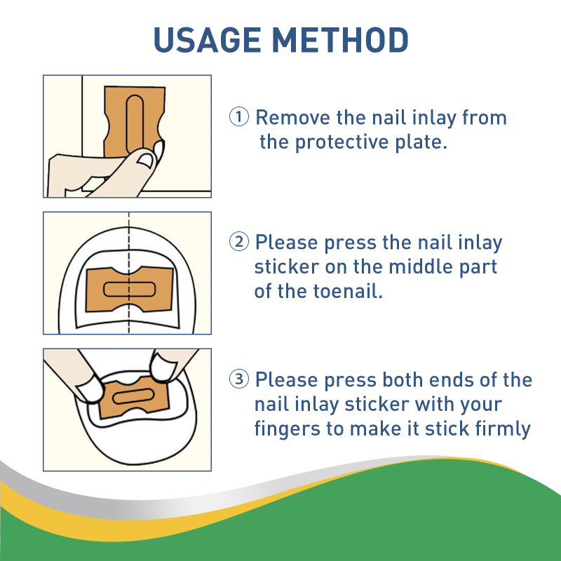 Jaysuing Toenail Furrow Correction, Toenail Insert Nail Repair Correction Pull-up Nail Nail Patch - Image 5