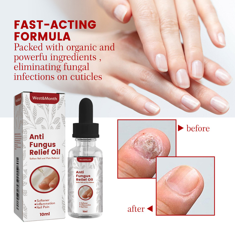 West&Month Nail Care Oil: Daily Gentle Care For The Feet, Making The Nails Smooth, Moist, Beautiful And Protecting The Nail Surface. - Image 3