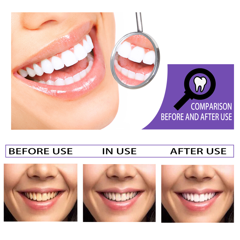EELHOE Teeth Whitening Toothpaste, Removing Teeth Stains And Odors Oral Care Brightening And Whitening Teeth Toothpaste - Image 4