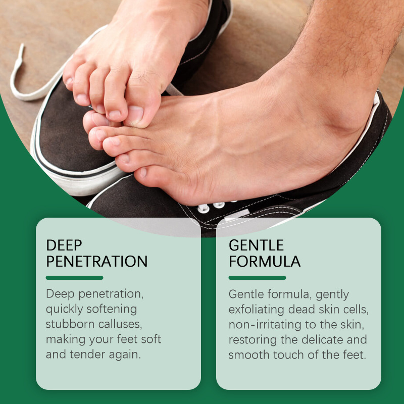 EELHOE Foot Exfoliating Care Spray, Green Tea Citrus Calluses Heel Elbow Knee Exfoliating Dead Skin - Image 3