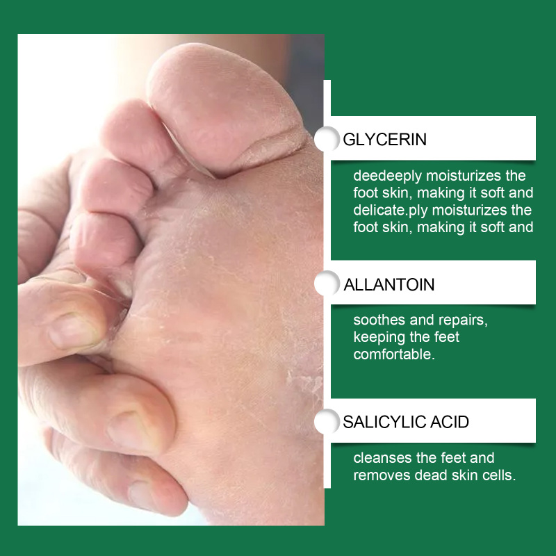 EELHOE Foot Exfoliating Care Spray, Green Tea Citrus Calluses Heel Elbow Knee Exfoliating Dead Skin - Image 4
