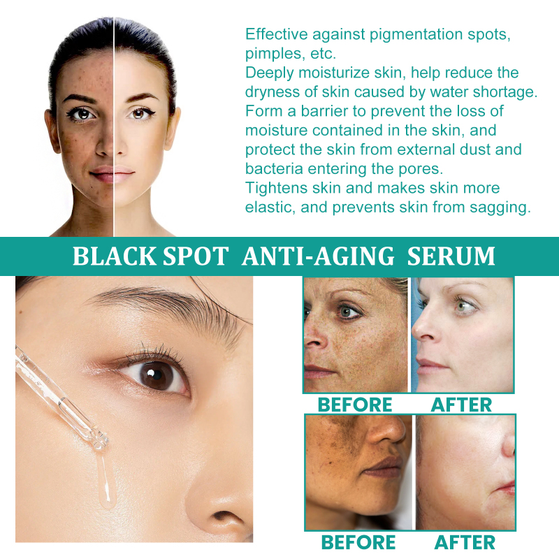 EELHOE Dark Spots Anti-Aging Serum, Lighten Dark Spots And Moisturize Skin Anti-Wrinkle Serum - Image 5