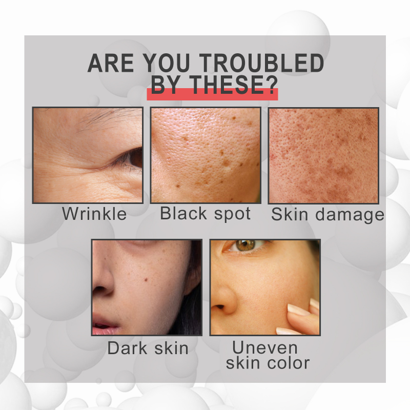 EELHOE Collagen Cream Collagen Moisturizes And Hydrates Fine Lines, Moisturizes And Tightens Skin - Image 4