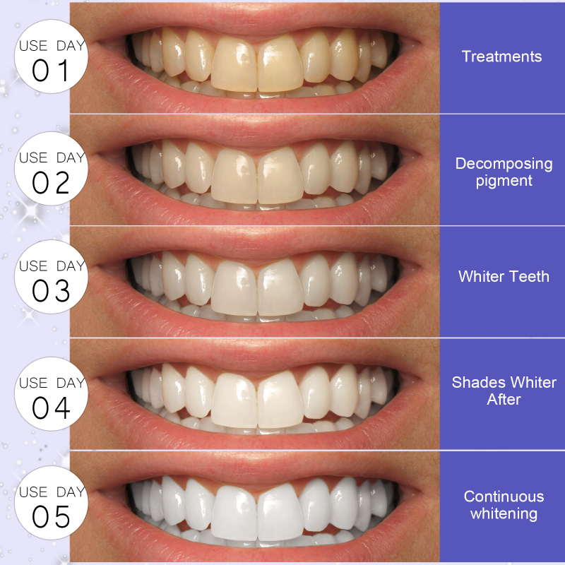 Jaysuing 5D Denture Whitening Denture Non-Acid Gel Denture Adhesive Denture Mold Oral Care Adhesive - Image 3