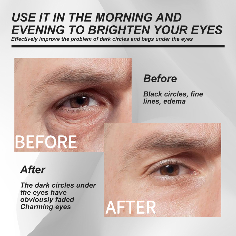 EELHOE Men's Eye Cream, Reduces Eye Bags Dark Circles Fine Lines Firming Skin And Moisturizing Eye Cream - Image 3