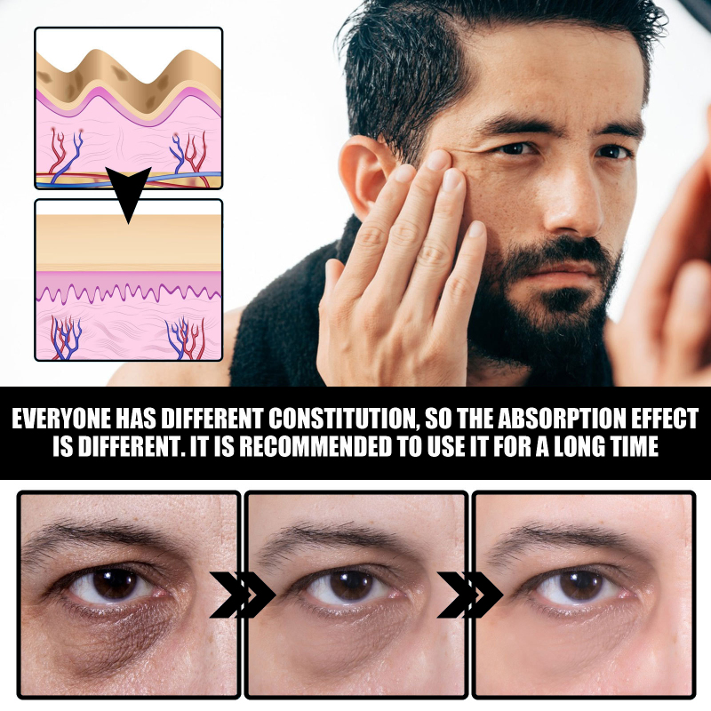 EELHOE Men's Eye Cream, Reduces Eye Bags Dark Circles Fine Lines Firming Skin And Moisturizing Eye Cream - Image 4