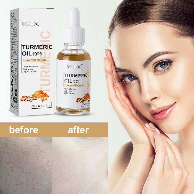 EELHOE Turmeric Correction Essence Facial Care Hydrating Moisturizing Gentle Moisturizing Skin Care Essence - Image 2