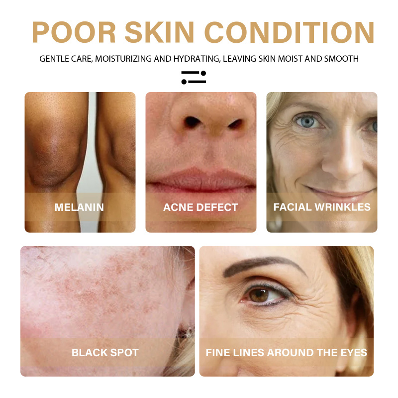EELHOE Turmeric Correction Essence Facial Care Hydrating Moisturizing Gentle Moisturizing Skin Care Essence - Image 3