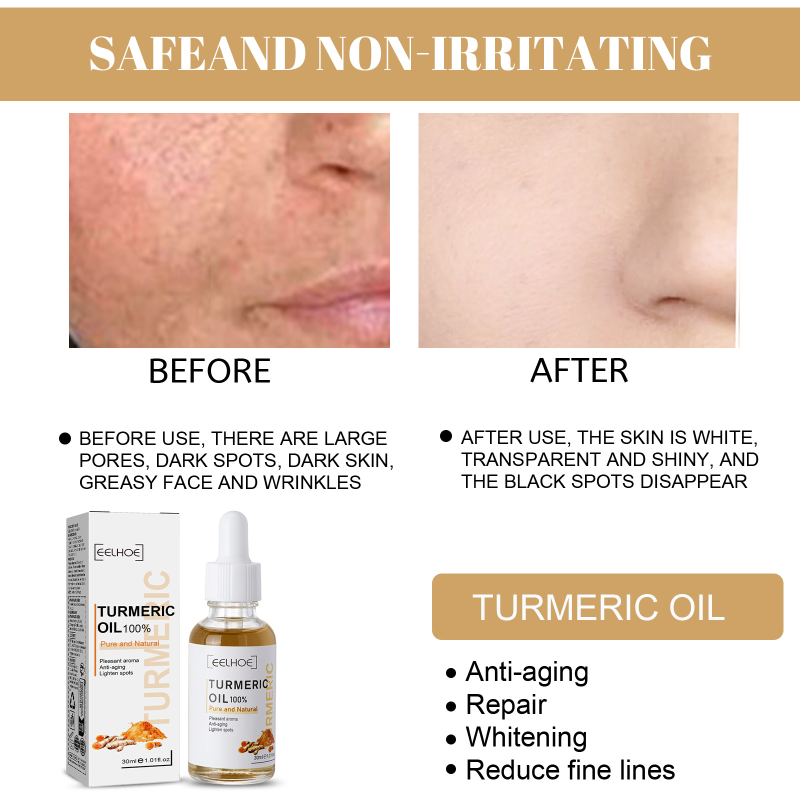 EELHOE Turmeric Correction Essence Facial Care Hydrating Moisturizing Gentle Moisturizing Skin Care Essence - Image 4