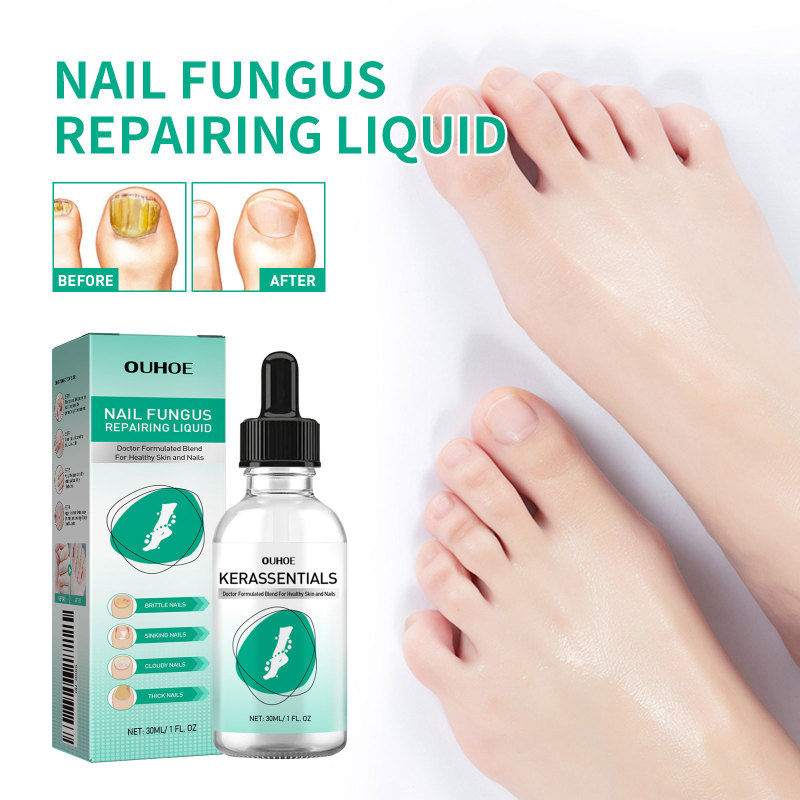 OUHOE Nail Care Soft, Nail Care Daily Clean Gentle Maintenance Moisturizing Nail Care Solution - Image 2