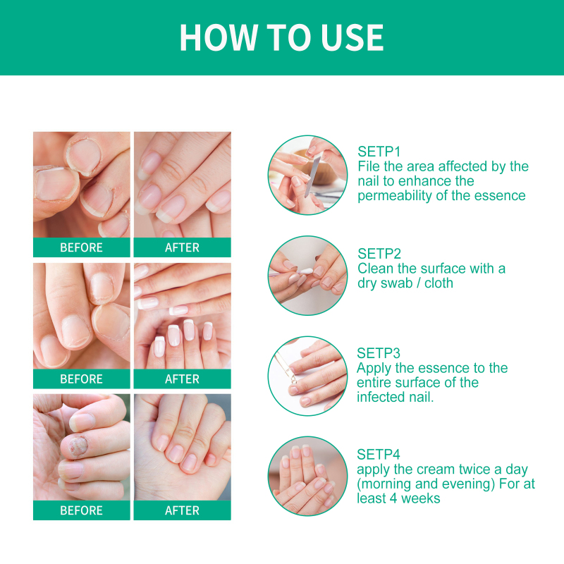 OUHOE Nail Care Soft, Nail Care Daily Clean Gentle Maintenance Moisturizing Nail Care Solution - Image 5