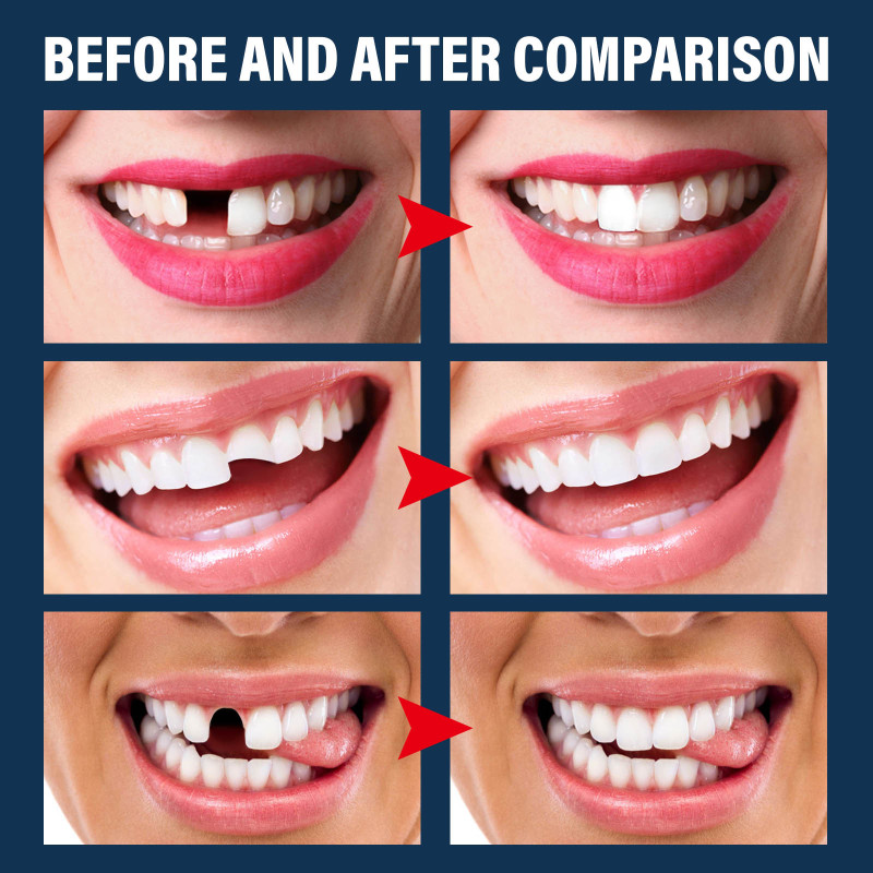 EELHOE Denture Decorative Teether Set, Halloween Vampire Makeup Dress Up Fake Tooth Glue Teeth Props - Image 4