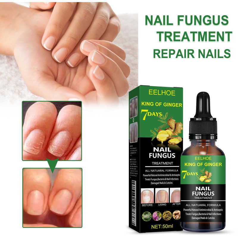EELHOE Nail Care Liquid - Daily Gentle Care For Nails, Moisturizing, Shining, Smooth Nail Surface, Convenient Care Liquid - Image 2