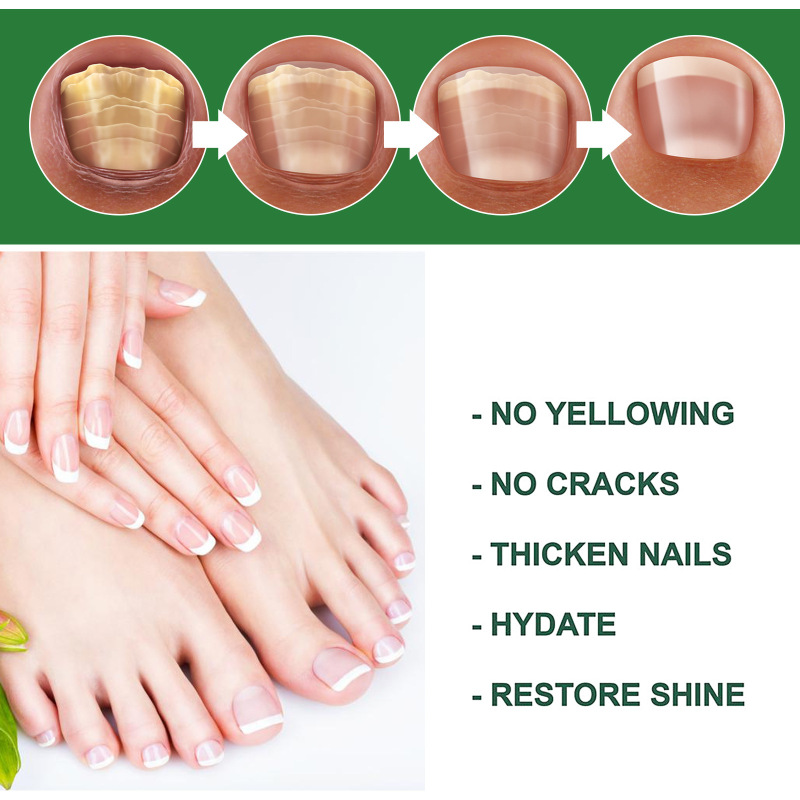EELHOE Nail Care Liquid - Daily Gentle Care For Nails, Moisturizing, Shining, Smooth Nail Surface, Convenient Care Liquid - Image 3