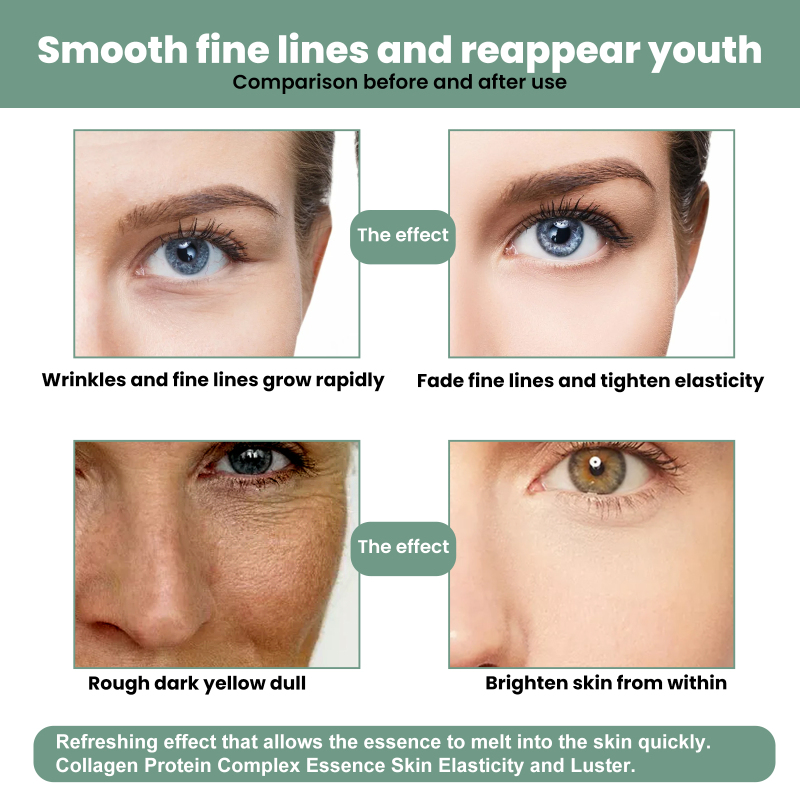 Jaysuing Collagen Face Serum For Reducing Fine Lines, Moisturizing, Hydrating And Firming Face Care - Image 4