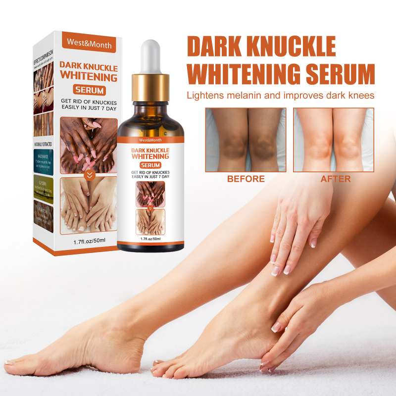West&Month Skin Blackening Essence, Brightening Knee Ankle Horn Melanin Removing Moisturizing Essence - Image 2