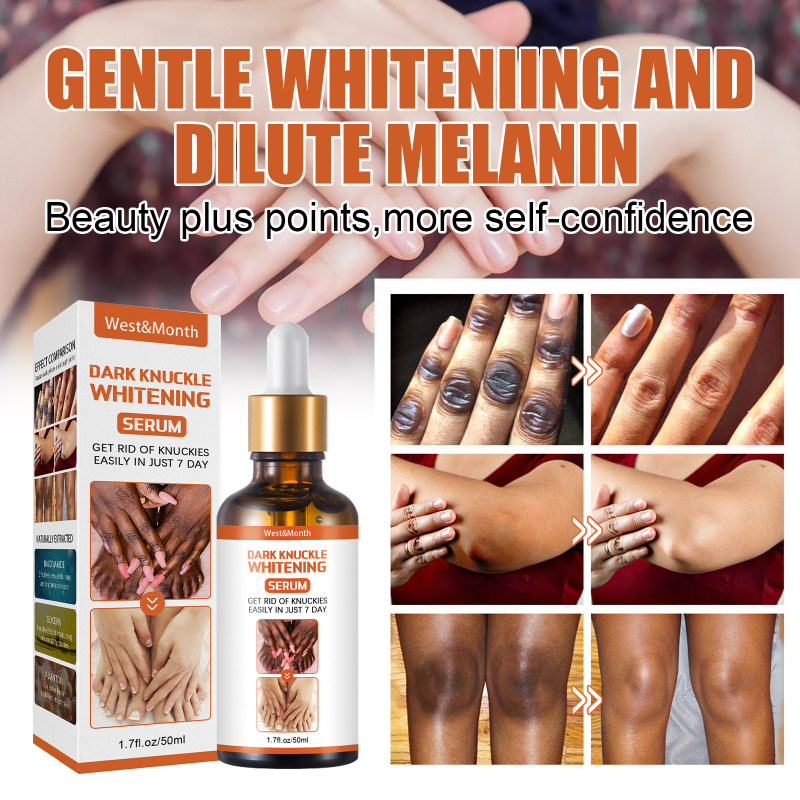 West&Month Skin Blackening Essence, Brightening Knee Ankle Horn Melanin Removing Moisturizing Essence - Image 3