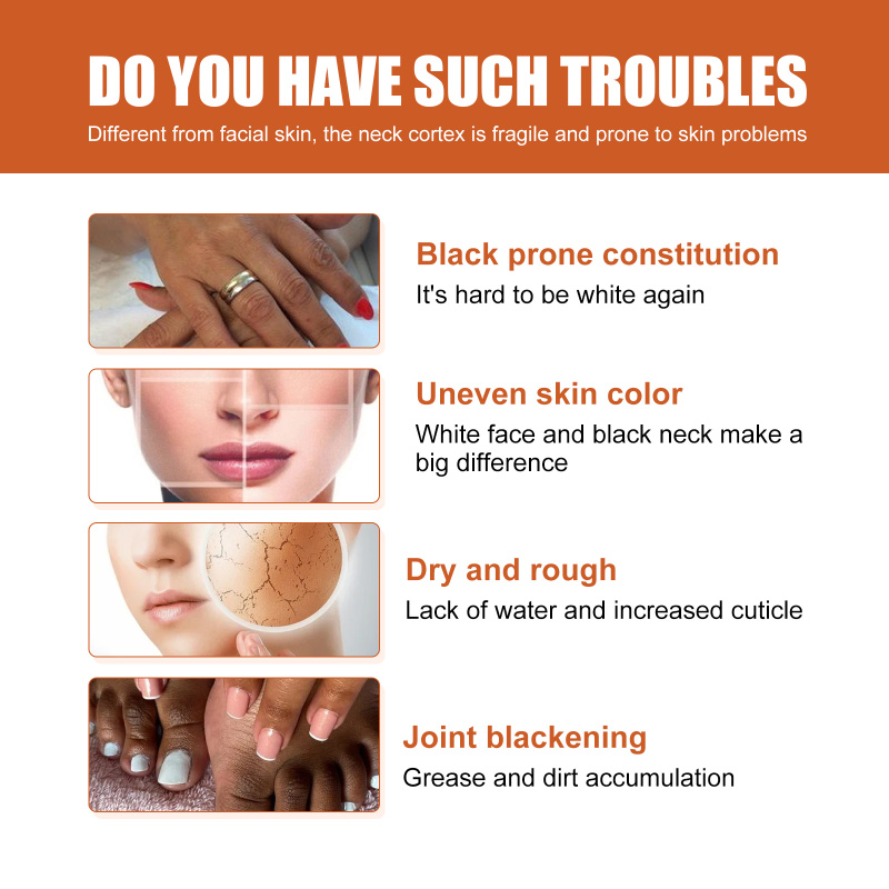 West&Month Skin Blackening Essence, Brightening Knee Ankle Horn Melanin Removing Moisturizing Essence - Image 4