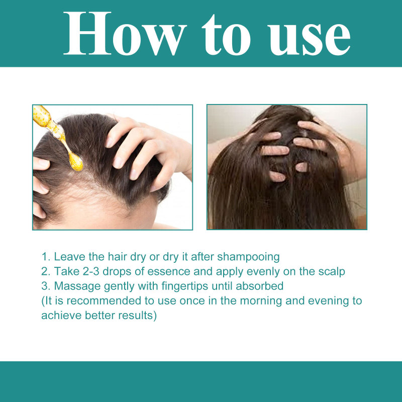 EELHOE Hair Care Essence, Nourishing And Moisturizing Hair, Soothing Hair And Scalp Massage Essence - Image 6