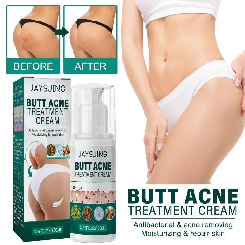 Jaysuing This Buttock Care Cream, Refreshing, Moisturizing Texture And Mild Ingredients. It Is A Body Cream That Provides Comfortable Care For Acne On The Buttocks - Image 2