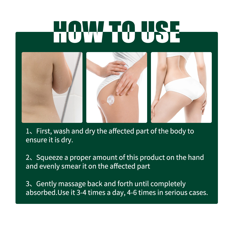 Jaysuing This Buttock Care Cream, Refreshing, Moisturizing Texture And Mild Ingredients. It Is A Body Cream That Provides Comfortable Care For Acne On The Buttocks - Image 6