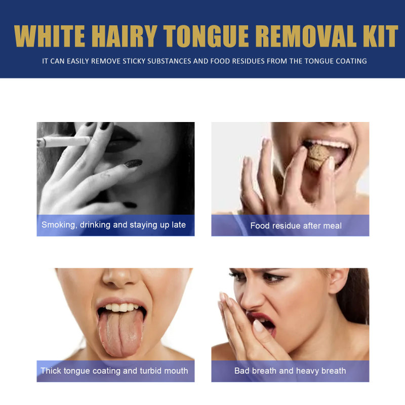 Jaysuing Tongue Coating Cleaning Set, Oral Care Remove Odors Fresh Breath Tongue Coating Cleaning Set - Image 3