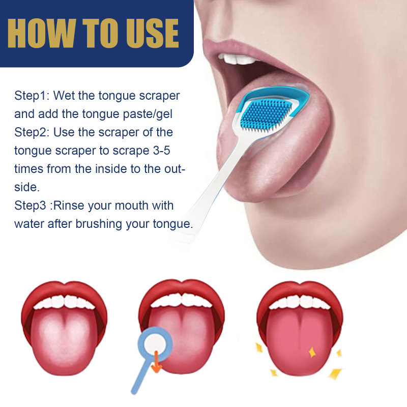 Jaysuing Tongue Coating Cleaning Set, Oral Care Remove Odors Fresh Breath Tongue Coating Cleaning Set - Image 6
