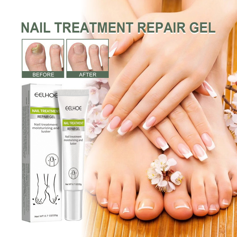 EELHOE Hand, Foot And Nail Repair, Soft Nail Polish Polish Gel - Image 2