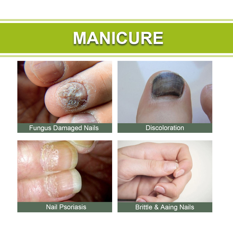 EELHOE Hand, Foot And Nail Repair, Soft Nail Polish Polish Gel - Image 3