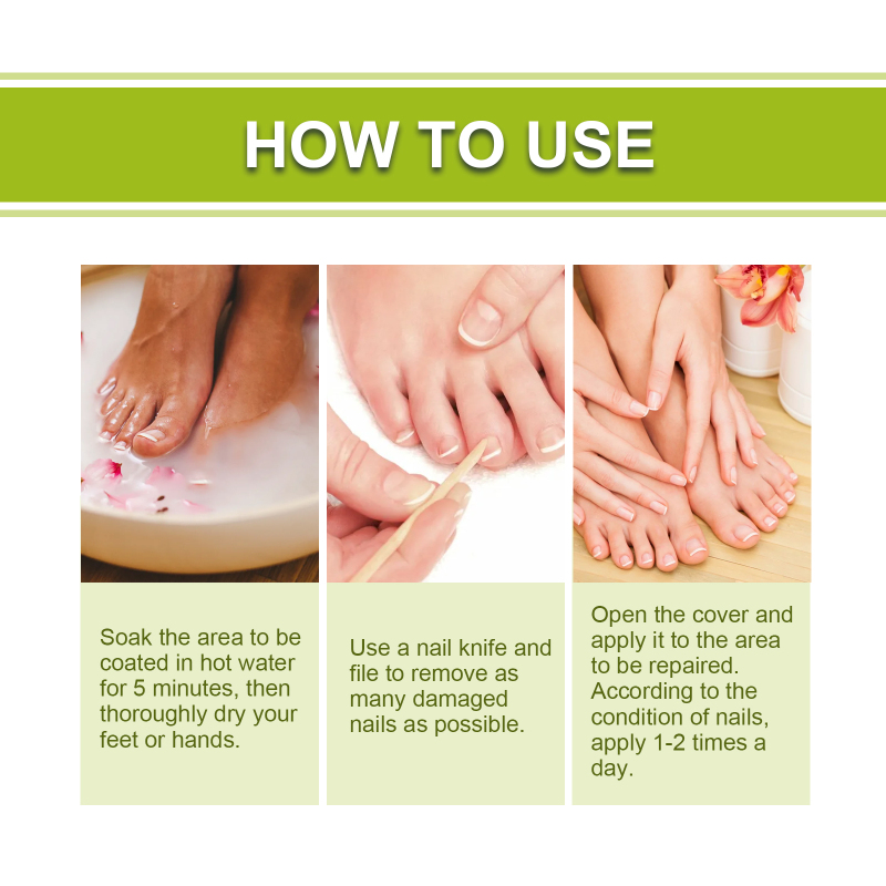 EELHOE Hand, Foot And Nail Repair, Soft Nail Polish Polish Gel - Image 6