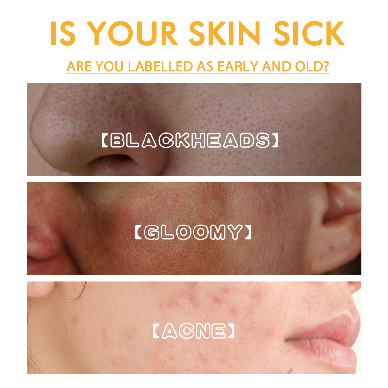 EELHOE Brightening Peel Mask, Gently Cleans Skin, Improves Facial Dullness, Hydrates And Moisturizes Peel Mask - Image 3