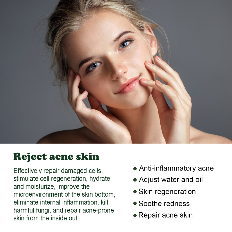EELHOE Tea Tree Acne Repair Essence, Lighten Acne, Clear Acne, Remove Acne, Repair Skin Essence - Image 3