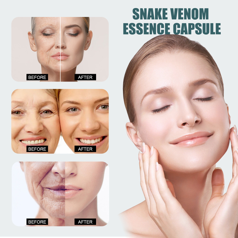 EELHOE Anti-Aging Essence Capsules, Firming And Lifting Moisturizing Facial Skin Lighten Fine Lines, Moisturize And Lighten Skin - Image 3