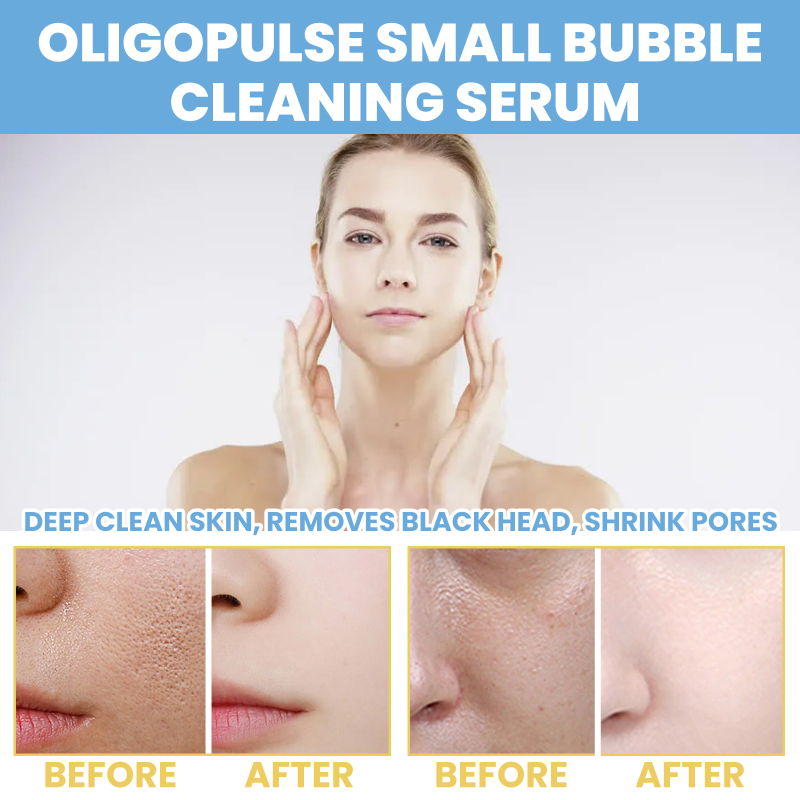 EELHOE Oligopeptide Mini Bubble Cleansing Essence, Pore-Tightening Skin Gentle Deep Clean Blackhead Acne - Image 3