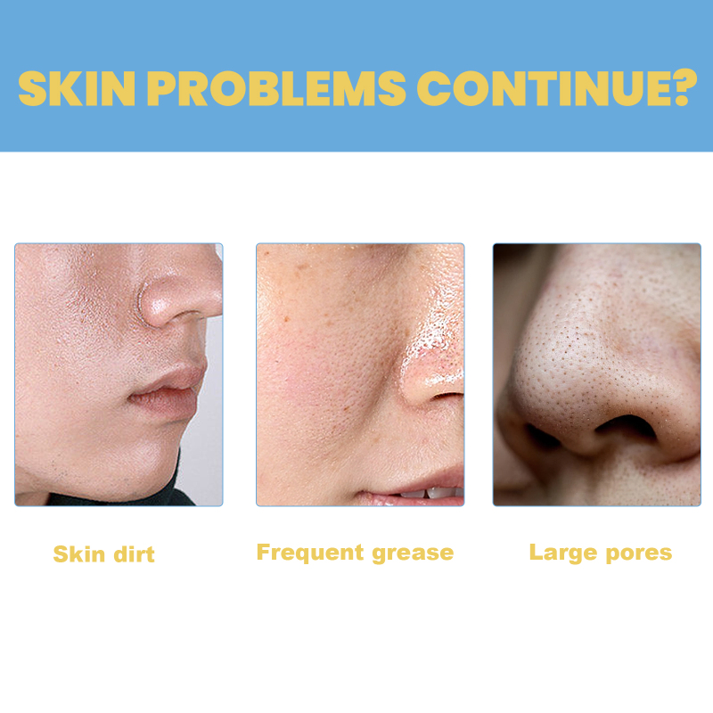 EELHOE Oligopeptide Mini Bubble Cleansing Essence, Pore-Tightening Skin Gentle Deep Clean Blackhead Acne - Image 4
