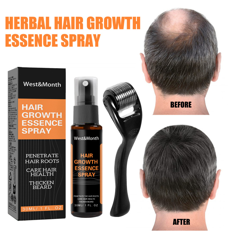 West&Month Polygonum Multiflorum Anti-Loss Hair Care Solution Hair Ginger Spray Thickening Hairline Treatment Solution - Image 2