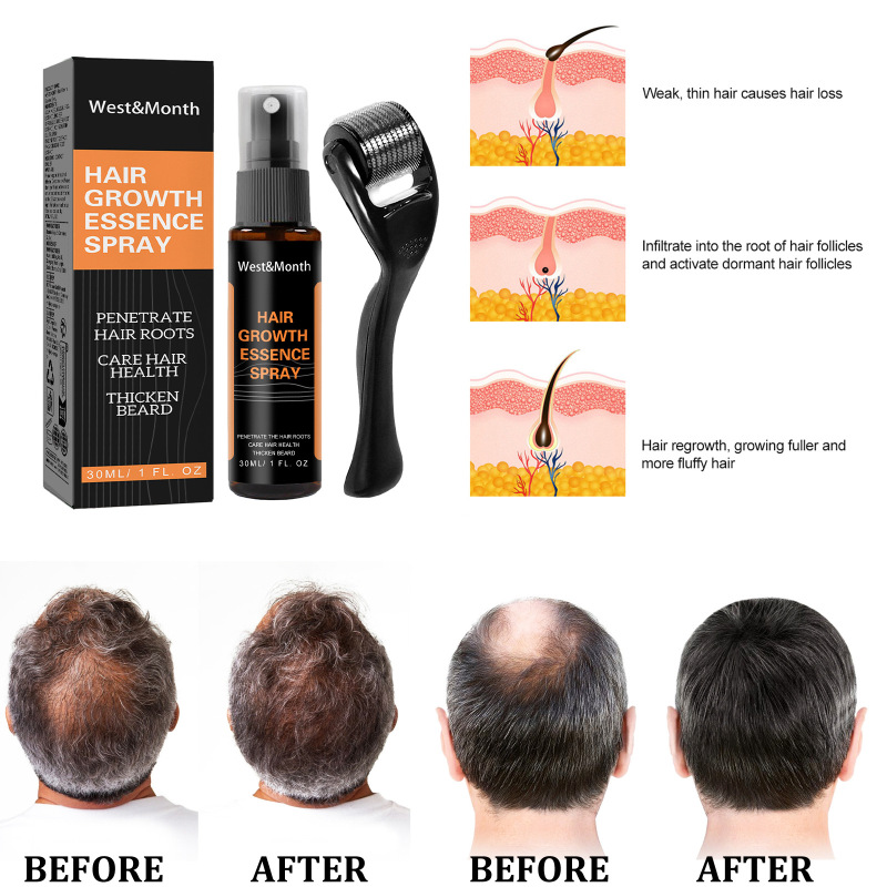 West&Month Polygonum Multiflorum Anti-Loss Hair Care Solution Hair Ginger Spray Thickening Hairline Treatment Solution - Image 3