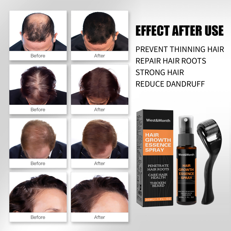 West&Month Polygonum Multiflorum Anti-Loss Hair Care Solution Hair Ginger Spray Thickening Hairline Treatment Solution - Image 4