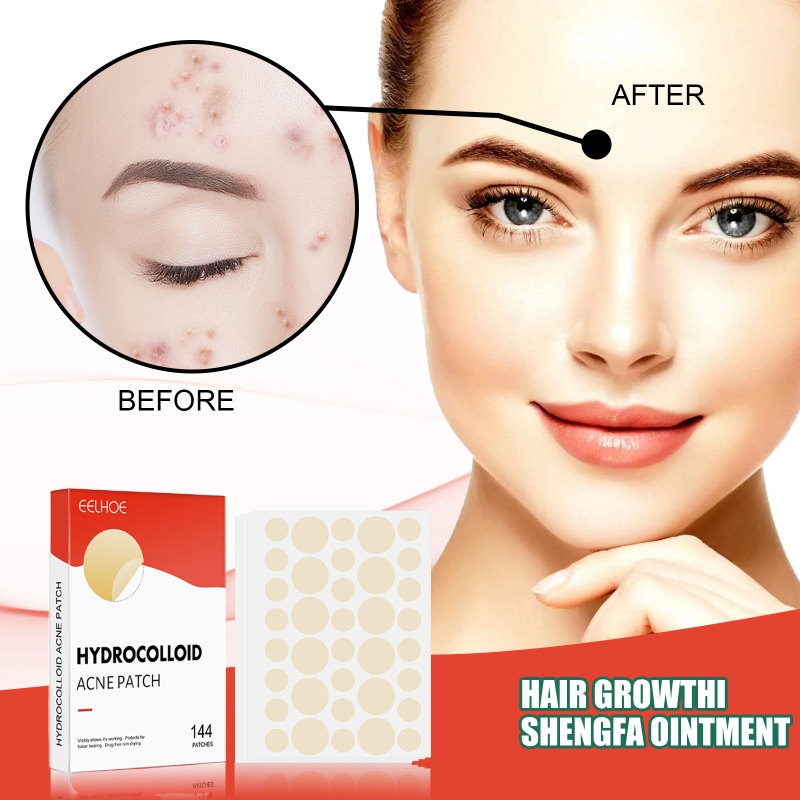EELHOE Hydrocolloid Acne Patch Face Invisible Makeup Closed Mouth Acne Clear Acne Waterproof Breathable Facial Treatment - Image 2