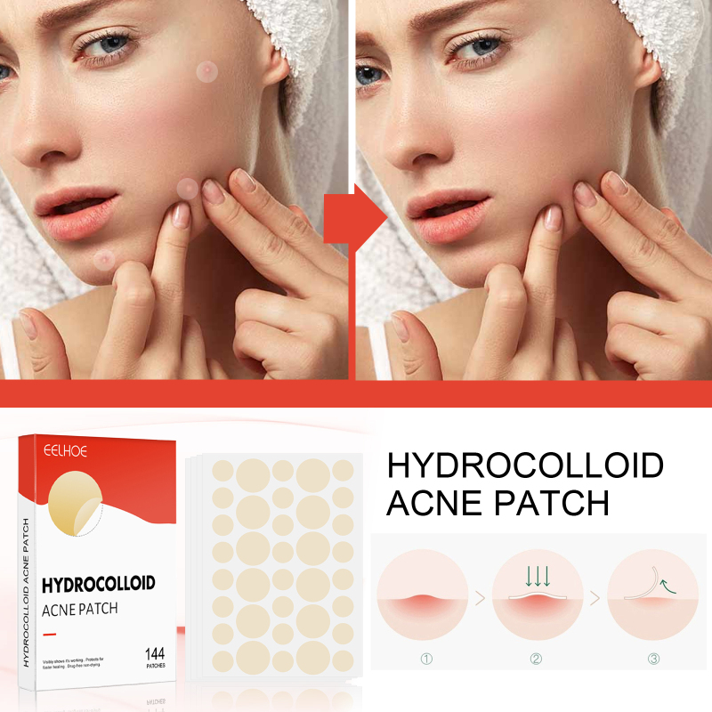 EELHOE Hydrocolloid Acne Patch Face Invisible Makeup Closed Mouth Acne Clear Acne Waterproof Breathable Facial Treatment - Image 3