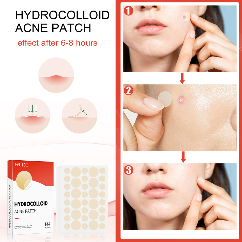 EELHOE Hydrocolloid Acne Patch Face Invisible Makeup Closed Mouth Acne Clear Acne Waterproof Breathable Facial Treatment - Image 4