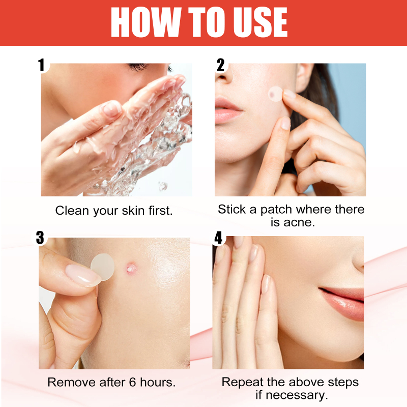 EELHOE Hydrocolloid Acne Patch Face Invisible Makeup Closed Mouth Acne Clear Acne Waterproof Breathable Facial Treatment - Image 6