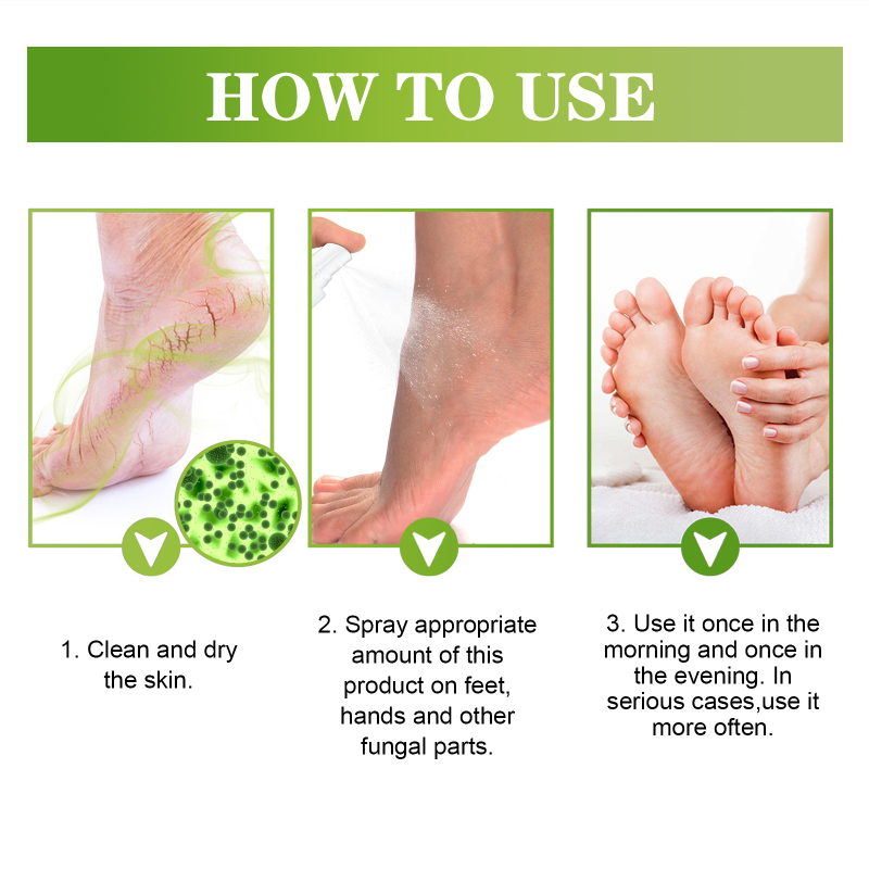 South Moon Fresh Foot Spray, Dry Feet Peeling Feet Itchy Moisturizing Skin Fragrance Spray - Image 6