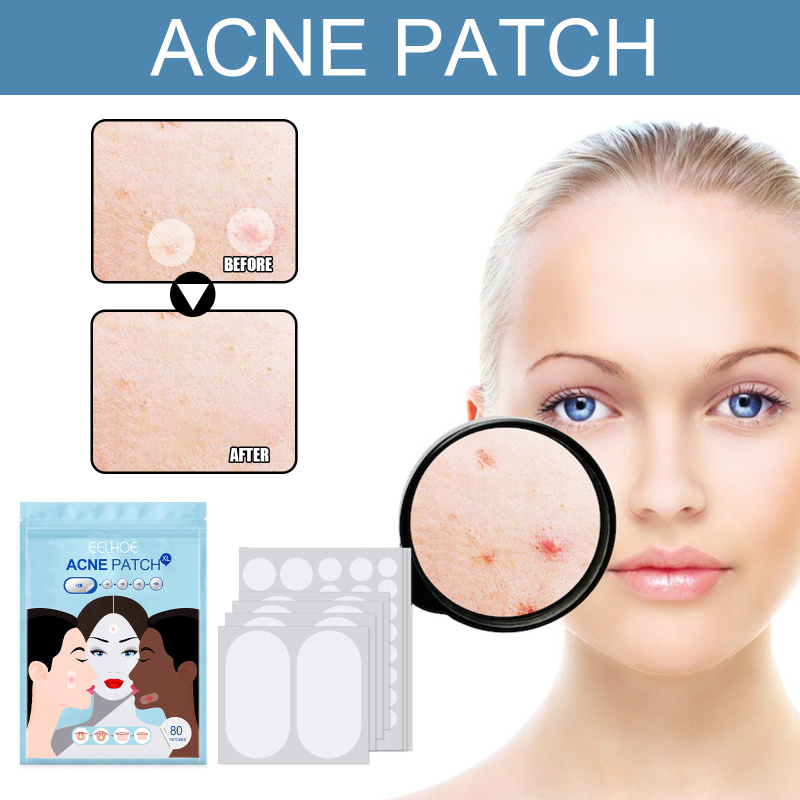 EELHOE Acne Patch, Hydrocolloidal Invisible Acne-Clearing Anti Acne And Pimple Waterproof Patch - Image 2