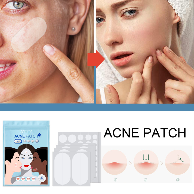 EELHOE Acne Patch, Hydrocolloidal Invisible Acne-Clearing Anti Acne And Pimple Waterproof Patch - Image 3